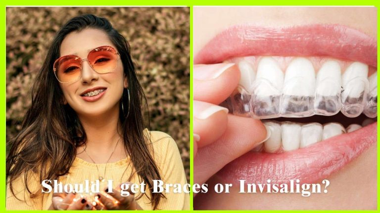 A comparison between braces and Invisalign to help users choose the best orthodontic treatment. | infooralhealth.com |