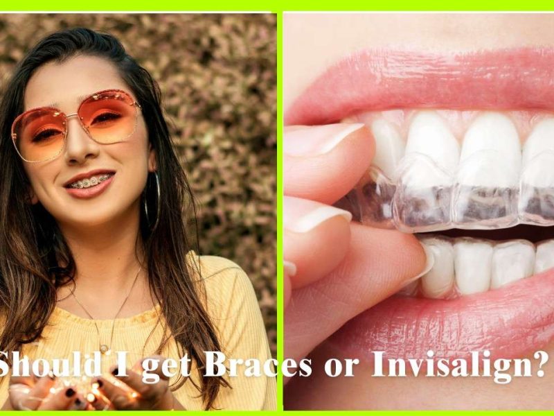 A comparison between braces and Invisalign to help users choose the best orthodontic treatment. | infooralhealth.com |